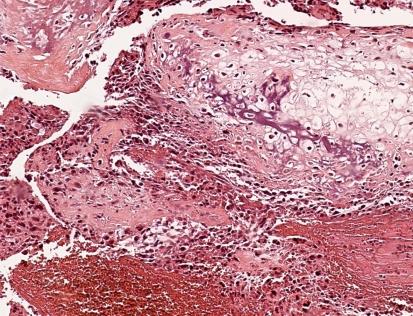 https://cdn.ncbi.nlm.nih.gov/pmc/blobs/15d5/2797586/1a4a2a28bf7b/cln64_12p1177f2.jpg