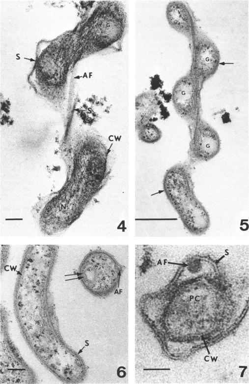 https://cdn.ncbi.nlm.nih.gov/pmc/blobs/15d6/249933/120d4e6aa8b2/jbacter00390-0300-a.jpg