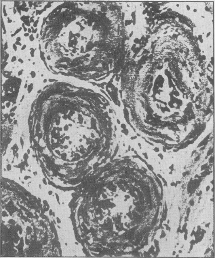 https://cdn.ncbi.nlm.nih.gov/pmc/blobs/15e0/2081336/1f5bf4aed97a/procrsmed00605-0018-d.jpg