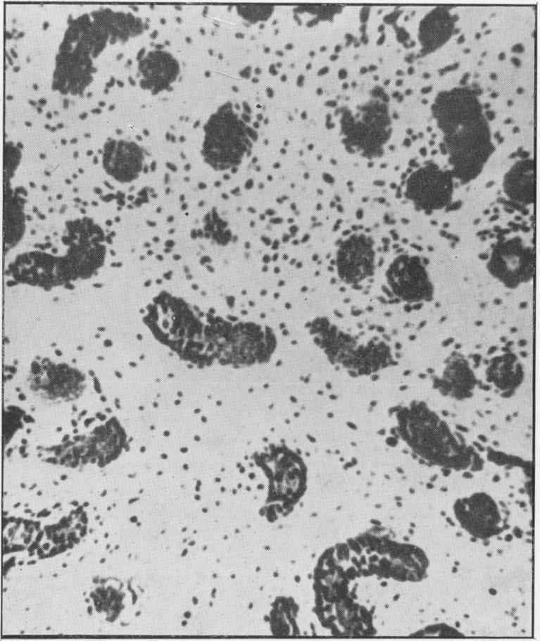 https://cdn.ncbi.nlm.nih.gov/pmc/blobs/15e0/2081336/8312f491ce30/procrsmed00605-0017-d.jpg