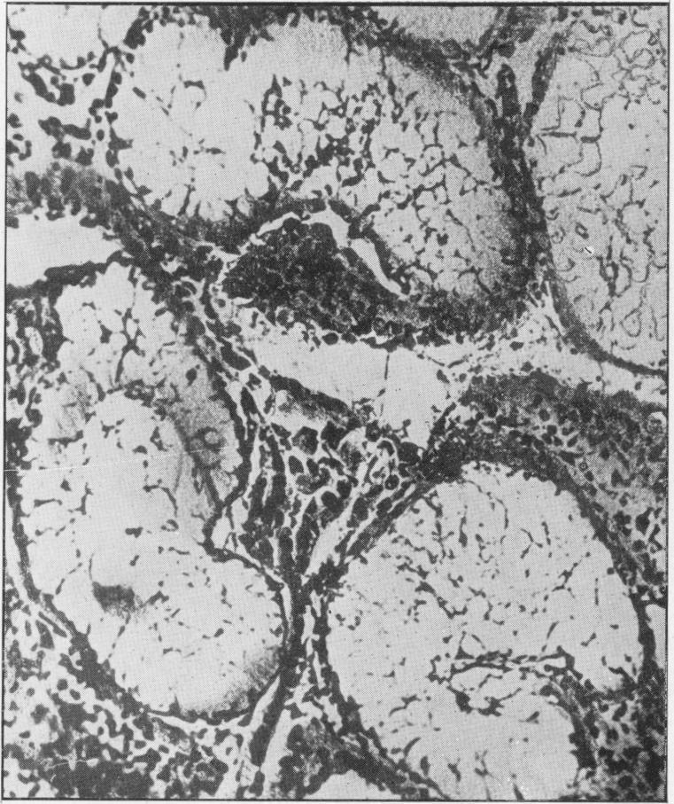https://cdn.ncbi.nlm.nih.gov/pmc/blobs/15e0/2081336/86b2f39b2217/procrsmed00605-0017-c.jpg