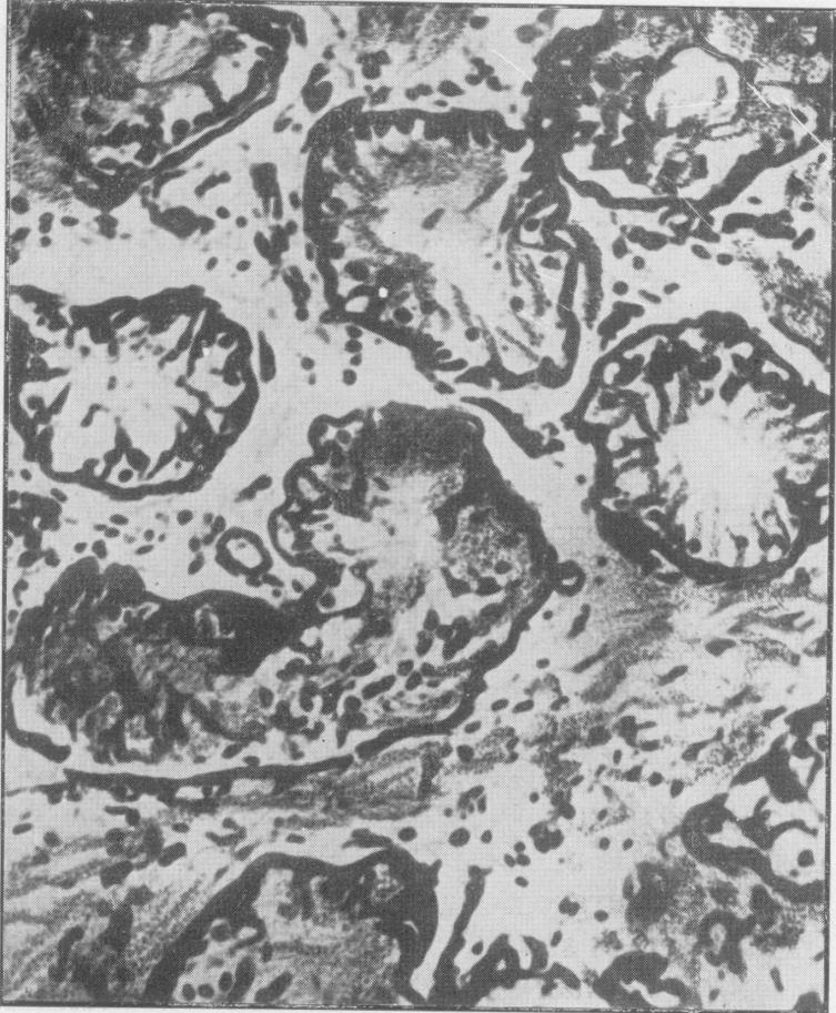 https://cdn.ncbi.nlm.nih.gov/pmc/blobs/15e0/2081336/cc4bf2efb522/procrsmed00605-0018-b.jpg