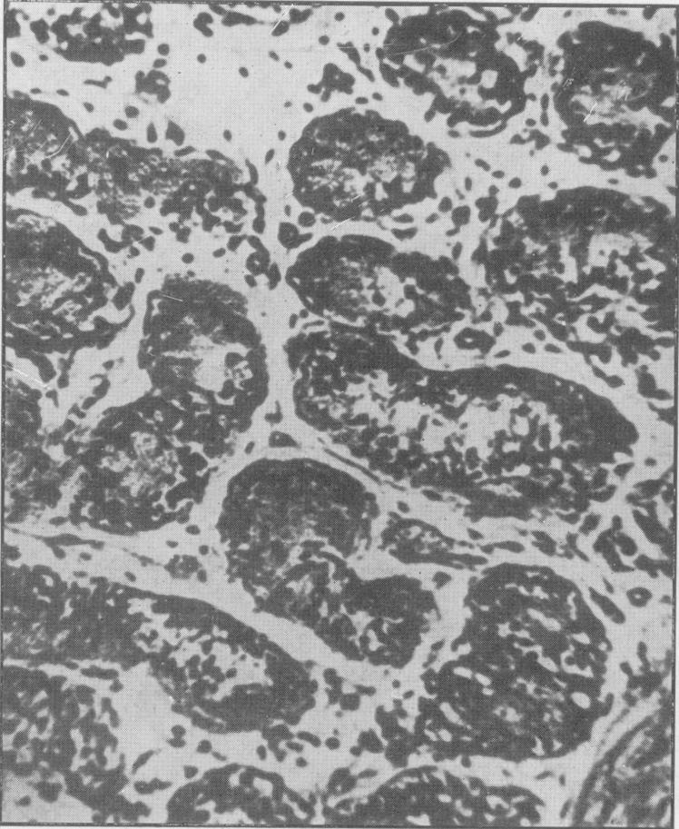 https://cdn.ncbi.nlm.nih.gov/pmc/blobs/15e0/2081336/d0cfe1212198/procrsmed00605-0018-a.jpg