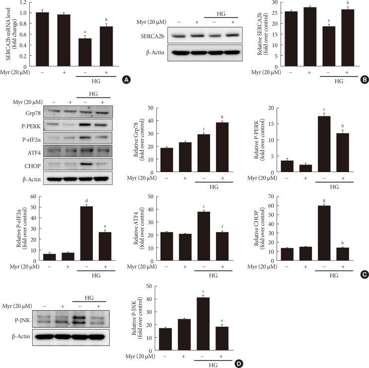 https://cdn.ncbi.nlm.nih.gov/pmc/blobs/15ee/6470101/bdb401a2b335/dmj-43-192-g005.jpg