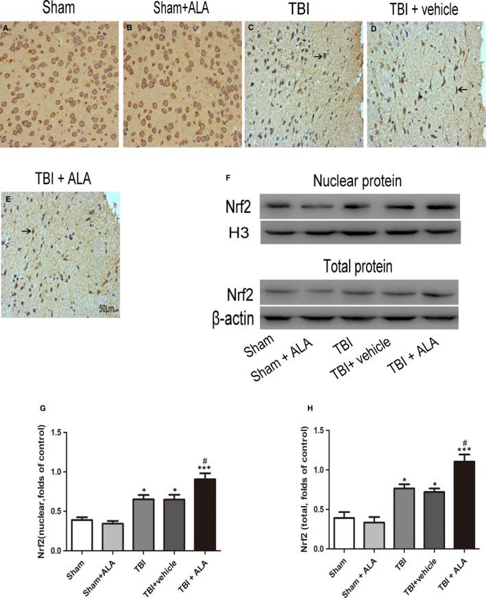 https://cdn.ncbi.nlm.nih.gov/pmc/blobs/15ef/6533507/b00f14334fe5/JCMM-23-4088-g003.jpg