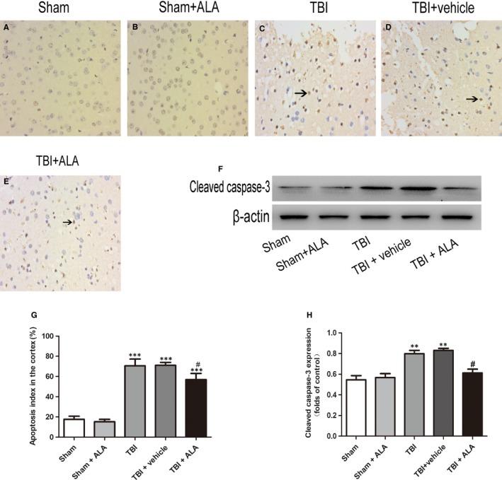 https://cdn.ncbi.nlm.nih.gov/pmc/blobs/15ef/6533507/c5c6474d294c/JCMM-23-4088-g004.jpg