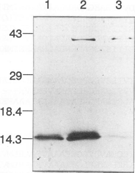 https://cdn.ncbi.nlm.nih.gov/pmc/blobs/15f6/186246/335e9184a809/iai00004-0041-a.jpg