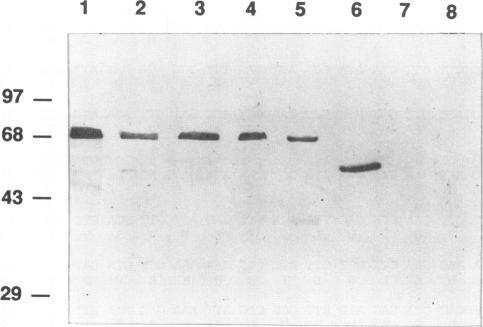 https://cdn.ncbi.nlm.nih.gov/pmc/blobs/15f6/186246/e4626b7b6305/iai00004-0039-a.jpg