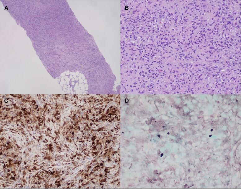 https://cdn.ncbi.nlm.nih.gov/pmc/blobs/15f6/9850267/76898803929c/ofac705f2.jpg