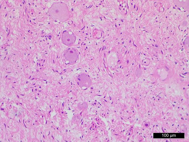 https://cdn.ncbi.nlm.nih.gov/pmc/blobs/15f9/10667774/1a492e82de9b/gr6.jpg