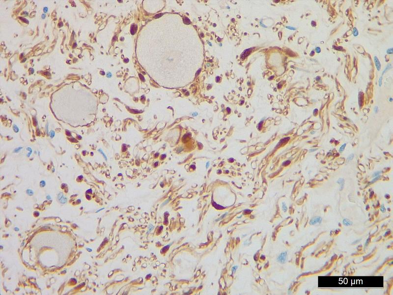 https://cdn.ncbi.nlm.nih.gov/pmc/blobs/15f9/10667774/dc9a40c7ceb7/gr7.jpg