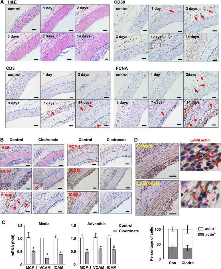 https://cdn.ncbi.nlm.nih.gov/pmc/blobs/15f9/5444729/45c869bc6093/oncotarget-08-30100-g001.jpg