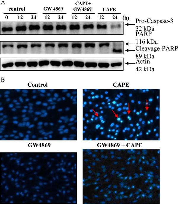 https://cdn.ncbi.nlm.nih.gov/pmc/blobs/160a/4227122/b62303d4b10a/1423-0127-21-61-6.jpg