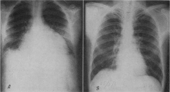 https://cdn.ncbi.nlm.nih.gov/pmc/blobs/160b/1923397/97705739ea62/canmedaj01236-0027-a.jpg