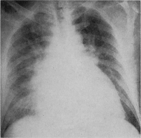 https://cdn.ncbi.nlm.nih.gov/pmc/blobs/160b/1923397/db3983ba7738/canmedaj01236-0029-c.jpg