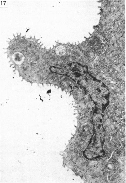 https://cdn.ncbi.nlm.nih.gov/pmc/blobs/1612/1165170/5b5d35c98ef9/janat00194-0161-c.jpg