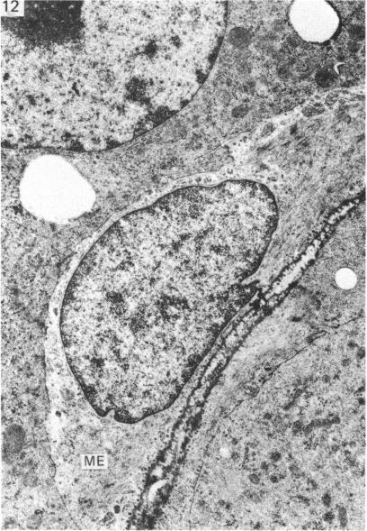 https://cdn.ncbi.nlm.nih.gov/pmc/blobs/1612/1165170/7f7fb048f140/janat00194-0159-a.jpg