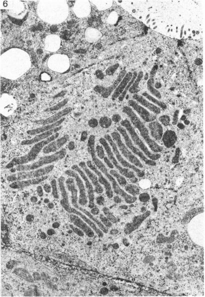 https://cdn.ncbi.nlm.nih.gov/pmc/blobs/1612/1165170/7f9ef34c7fd1/janat00194-0155-c.jpg