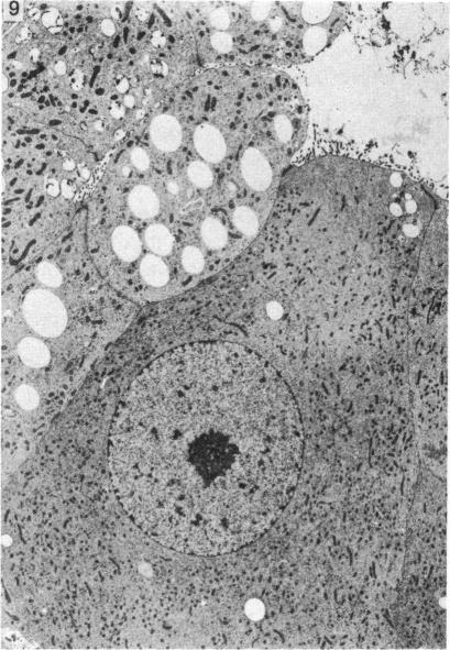 https://cdn.ncbi.nlm.nih.gov/pmc/blobs/1612/1165170/e5e4775309b1/janat00194-0157-b.jpg