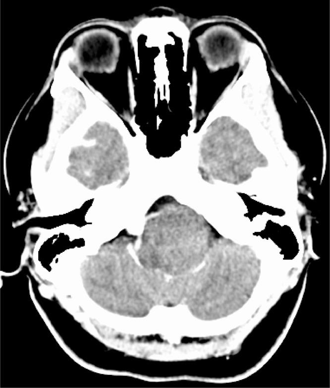https://cdn.ncbi.nlm.nih.gov/pmc/blobs/1614/7568188/1c5c44113d93/gr2.jpg