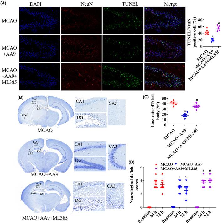 https://cdn.ncbi.nlm.nih.gov/pmc/blobs/1618/10173707/e6630f0a8d40/CNS-29-1667-g002.jpg