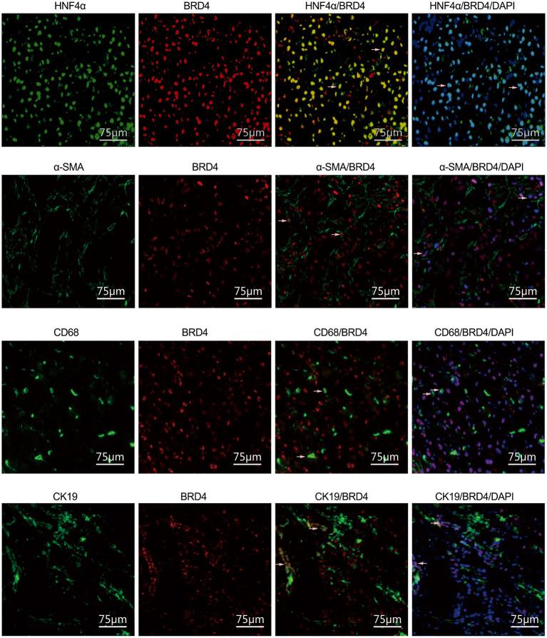 https://cdn.ncbi.nlm.nih.gov/pmc/blobs/161a/8317578/9161012515fa/fmed-08-683506-g0003.jpg