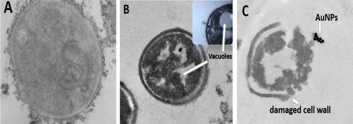https://cdn.ncbi.nlm.nih.gov/pmc/blobs/161f/6137858/f9cd68df605e/gr4.jpg