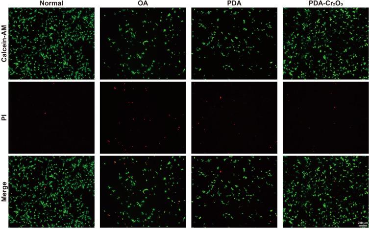https://cdn.ncbi.nlm.nih.gov/pmc/blobs/1622/12399218/108cf7a45c8f/IJN-20-10369-g0007.jpg