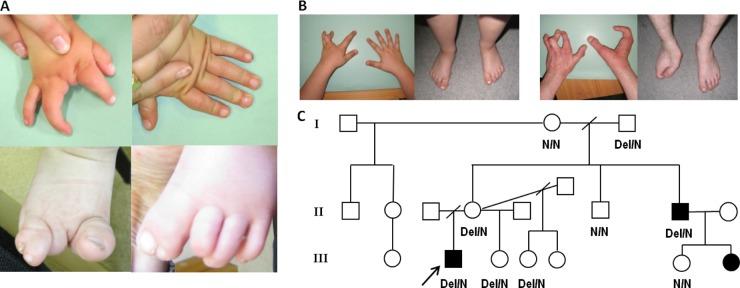 https://cdn.ncbi.nlm.nih.gov/pmc/blobs/1624/3963551/c7ae21034ca0/jmedgenet-2013-102142f01.jpg