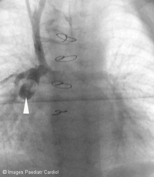 https://cdn.ncbi.nlm.nih.gov/pmc/blobs/1627/3232557/82dfa7428d16/IPC-7-10-g018.jpg