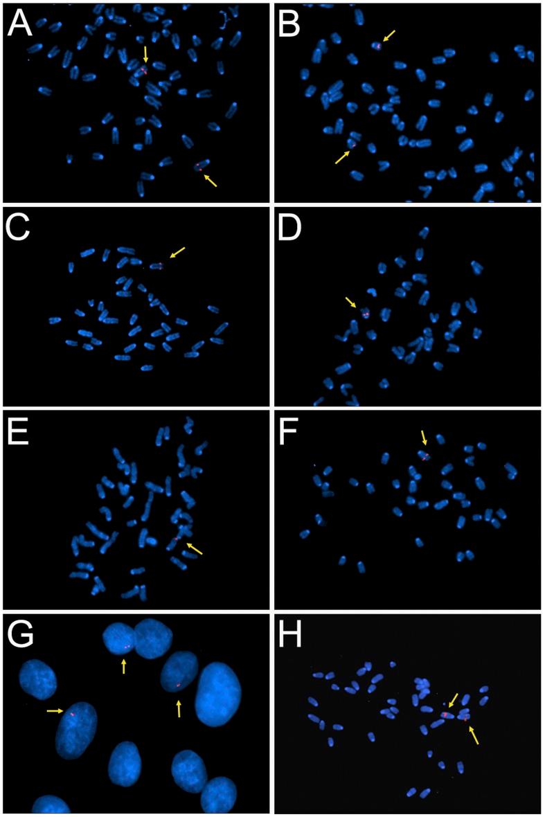 https://cdn.ncbi.nlm.nih.gov/pmc/blobs/1629/3392231/199b266da534/pone.0040609.g002.jpg