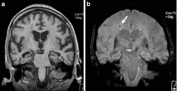 https://cdn.ncbi.nlm.nih.gov/pmc/blobs/162b/3288993/e0f828b61722/13244_2011_86_Fig4_HTML.jpg