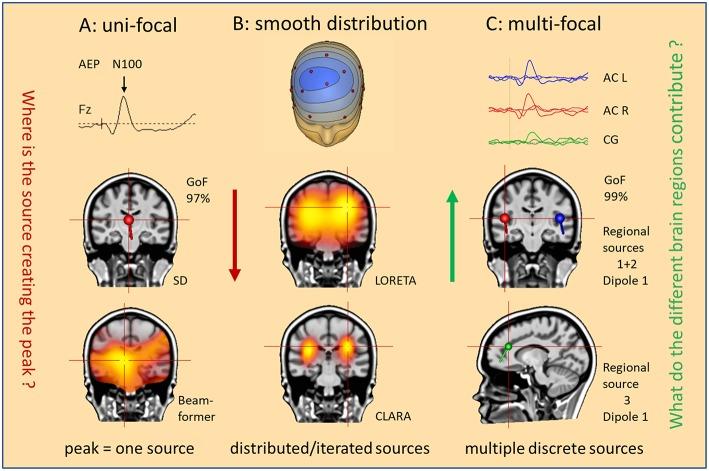 https://cdn.ncbi.nlm.nih.gov/pmc/blobs/162b/6710389/8075198f15bd/fneur-10-00855-g0002.jpg