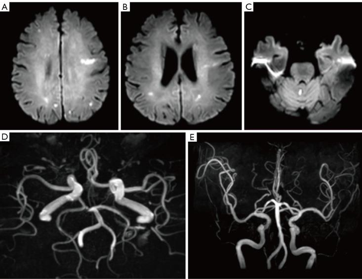 https://cdn.ncbi.nlm.nih.gov/pmc/blobs/1632/10784078/f5b6e50574ad/qims-14-01-365-f3.jpg