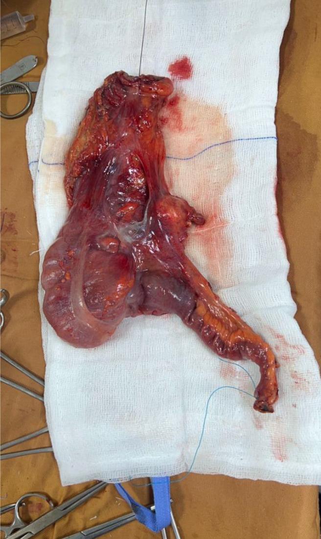 https://cdn.ncbi.nlm.nih.gov/pmc/blobs/1634/12188753/b839f42be8db/wjcc-13-22-104352-g003.jpg