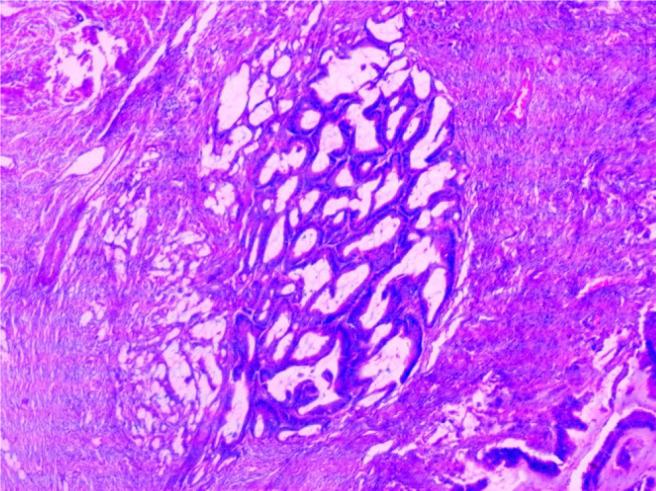 https://cdn.ncbi.nlm.nih.gov/pmc/blobs/1634/12188753/f156334574ae/wjcc-13-22-104352-g002.jpg