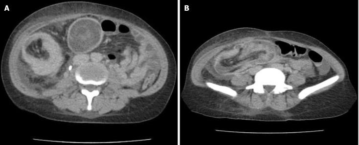 https://cdn.ncbi.nlm.nih.gov/pmc/blobs/1634/12188753/fdf7d779a688/wjcc-13-22-104352-g001.jpg
