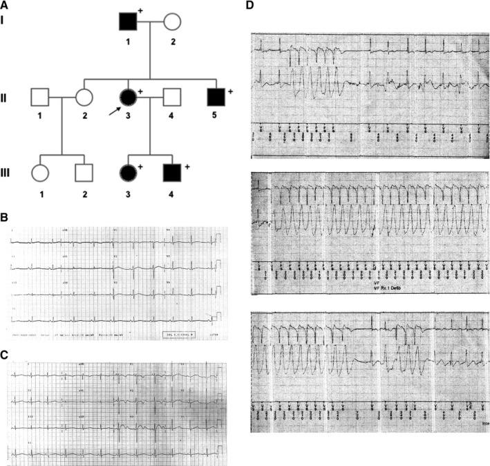 https://cdn.ncbi.nlm.nih.gov/pmc/blobs/1638/6714209/6479470cc853/JCMM-23-6331-g001.jpg