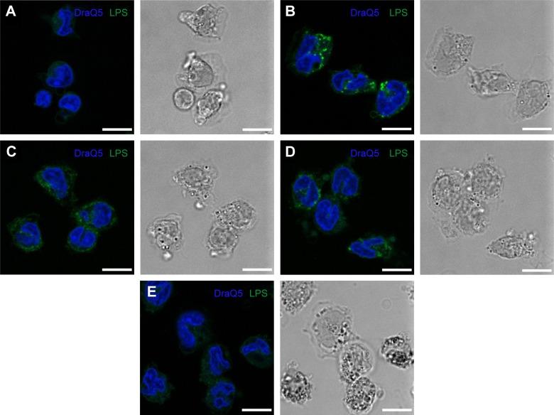 https://cdn.ncbi.nlm.nih.gov/pmc/blobs/163d/5028097/56b1be2ba360/ijn-11-4625Fig8.jpg