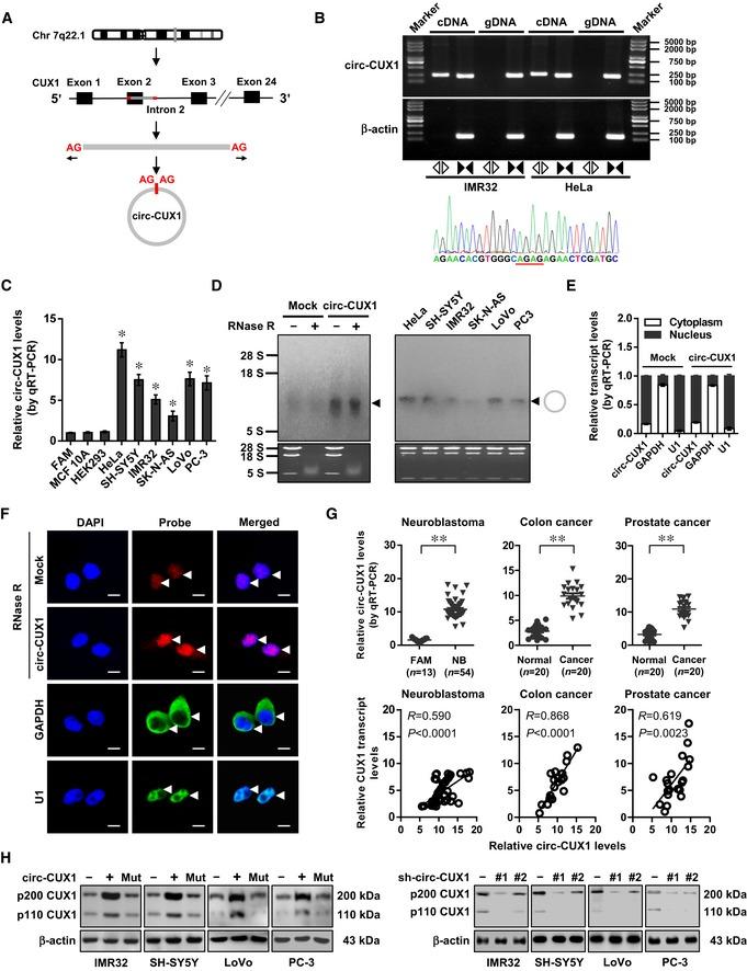 https://cdn.ncbi.nlm.nih.gov/pmc/blobs/163f/6895612/029a8de07ea7/EMMM-11-e10835-g004.jpg