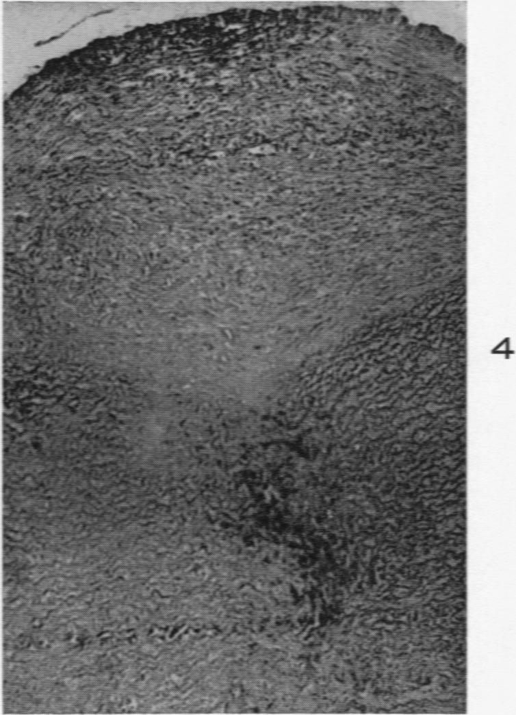 https://cdn.ncbi.nlm.nih.gov/pmc/blobs/1641/1942540/3546c967c8c8/amjpathol00704-0190-d.jpg