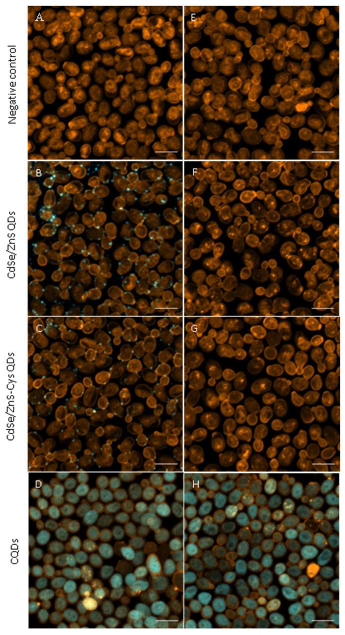 https://cdn.ncbi.nlm.nih.gov/pmc/blobs/1644/10781119/34c169a0f392/nanomaterials-14-00010-g008.jpg