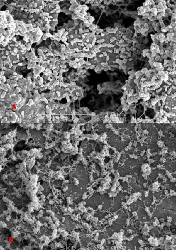 https://cdn.ncbi.nlm.nih.gov/pmc/blobs/1647/2858741/5c5da57c64a5/1471-2180-10-98-3.jpg