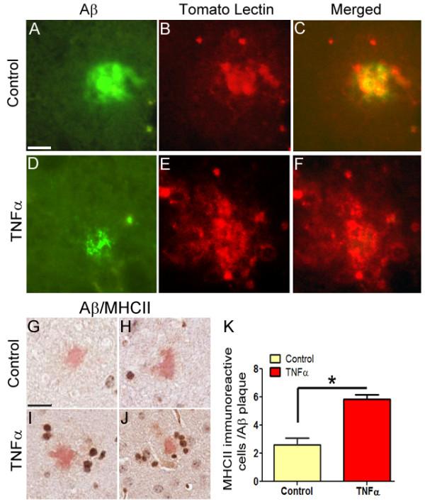 https://cdn.ncbi.nlm.nih.gov/pmc/blobs/1649/3050766/e55db712d7a0/1750-1326-6-16-5.jpg