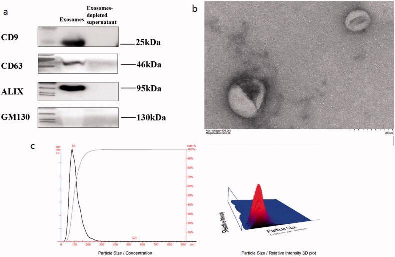 https://cdn.ncbi.nlm.nih.gov/pmc/blobs/164b/9879181/aaed9029a97a/IRNF_A_2121929_F0001_C.jpg