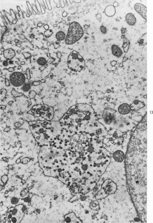 https://cdn.ncbi.nlm.nih.gov/pmc/blobs/164e/1965329/16d049edf37b/amjpathol00260-0062-a.jpg