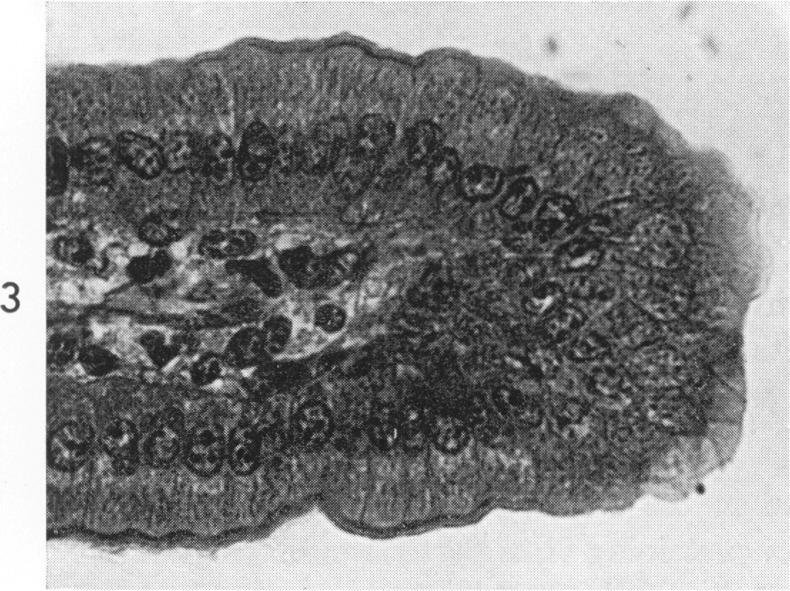 https://cdn.ncbi.nlm.nih.gov/pmc/blobs/164e/1965329/4d40a692f846/amjpathol00260-0052-c.jpg
