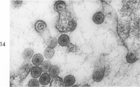 https://cdn.ncbi.nlm.nih.gov/pmc/blobs/164e/1965329/5fb947190d15/amjpathol00260-0064-a.jpg