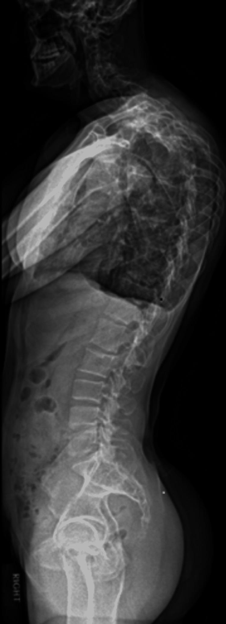 https://cdn.ncbi.nlm.nih.gov/pmc/blobs/1655/9155590/42a642e5c936/cureus-0014-00000024651-i02.jpg