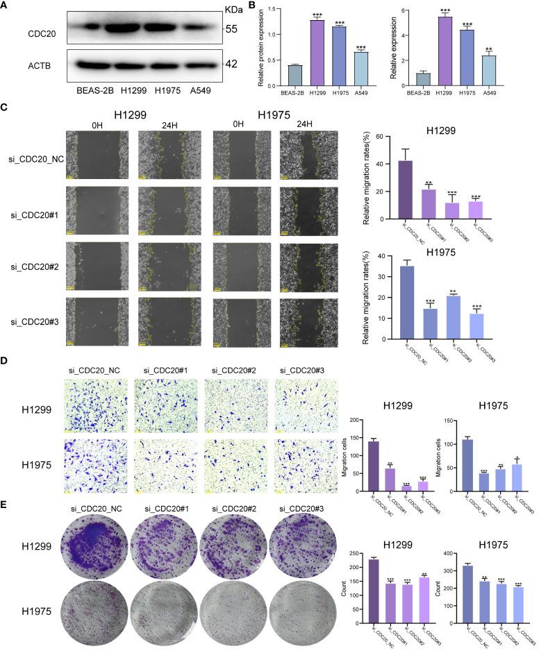 https://cdn.ncbi.nlm.nih.gov/pmc/blobs/165a/11303833/6687b979e491/fonc-14-1351393-g006.jpg
